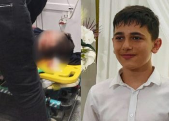 Makineye kafası sıkışan çocuk yaşam savaşı veriyor