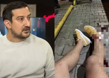 Silahlı saldırıya uğrayan Serhat Akın’ın ilk ifadesi: 4 yorumcunun ismini verdi